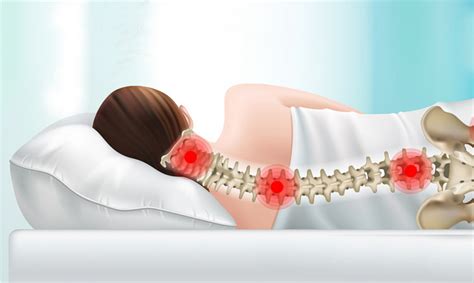 масаж на шийния отдел на гръбначния стълб при остеохондроза видео